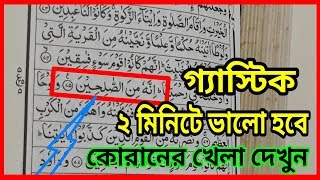 গ্যাস্টিক ২ মিনিটে ভালো হবে কোরানের দোয়া টি পড়ুন