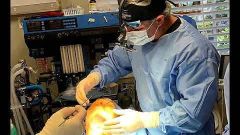 My Ellevate and Tightening of The Neck by Dr. Greg...