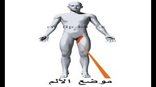 العضلة المقربة - أخطر إصابة في فتحة الحوض. أنا أعرف العلاج. إنه يوتيوب مهم جدًا جدًا