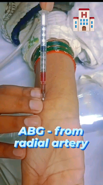 How to Take a Radial Arterial Blood Gas (ABG) Sample' / #medical #information #about #abg #simple