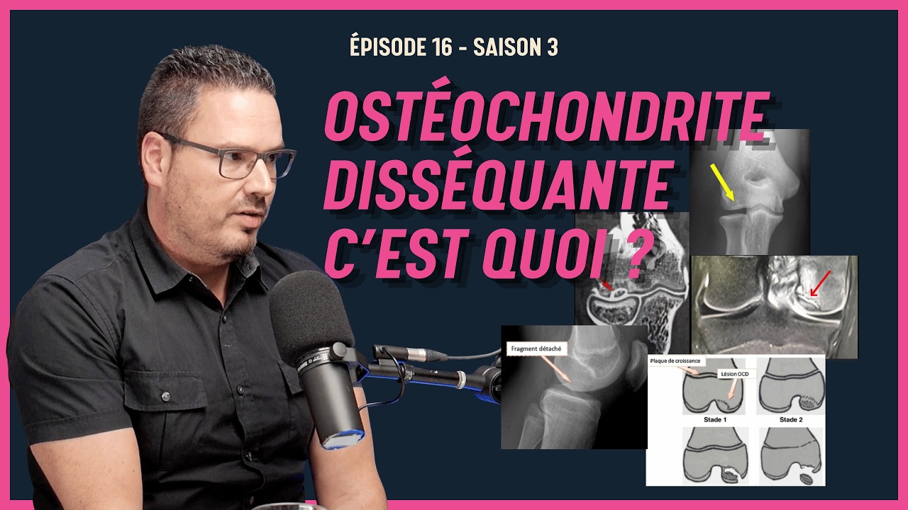 Ostéochondrite disséquante avec le Dr Olivier Chemaly