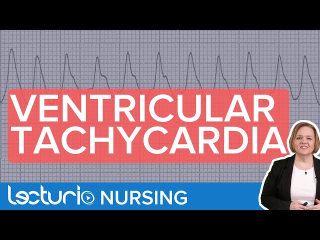 Ventricular Tachycardia: ECG Interpretation & Presentation class=