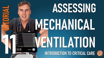 Assessing Mechanical Ventilation