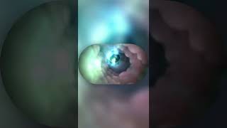 Funny Bone Skylander