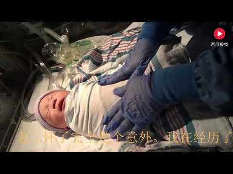 顺产和剖腹产的区别是什么？哪个更痛！