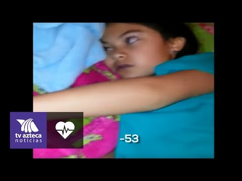 Video: ¿Son reales las convulsiones psicógenas?