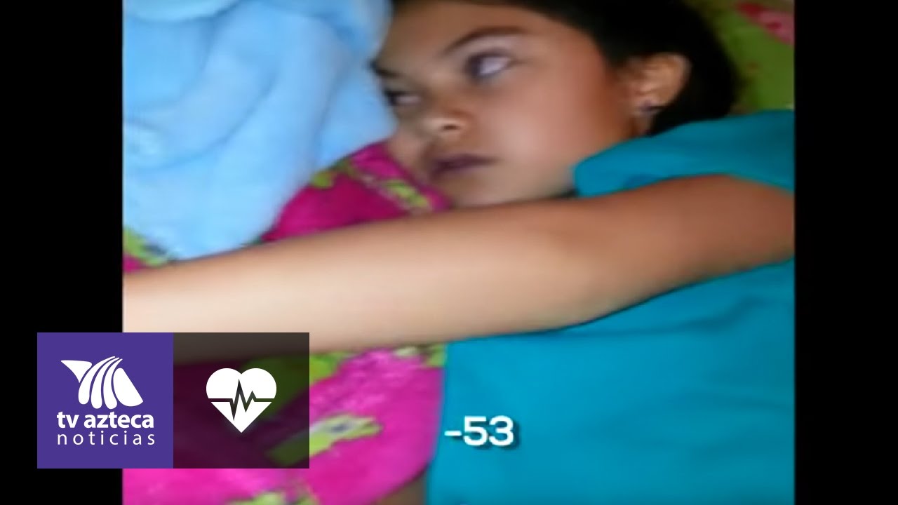 porque dan las convulsiones en bebes
