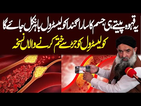 How To Naturally Improve Your Cholesterol Management Cholesterol Ka Ilaj Dr Sharafat Ali