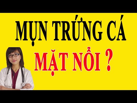 [ Ngạc Nhiên ] Mặt Tự Nhiên Nổi Nhiều Mụn Trứng Cá