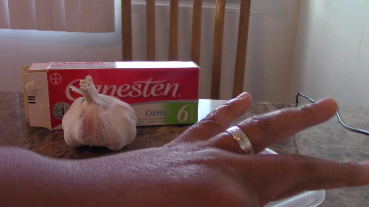 Les astuces; secrets de femme comment lutter contre les pertes blanches