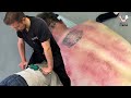 Chiropractor puts full weight  into mans back to loosen tight joints  gua sha  a crunchy neck