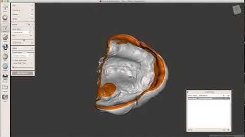 Digital Complete Dentures Meshmixer Mx Impression Preparation