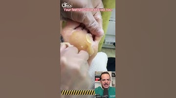 DOCTOR REACTS TO SHAVING HIGH HEELS 👠 CALLUS!😱😳#shorts #satisfying