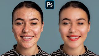 Face Retouching  Best Photoshop Tutorial | Skin Retouching