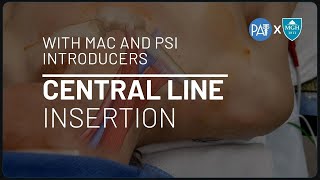 Central Line Insertion with MAC and PSI Introducers