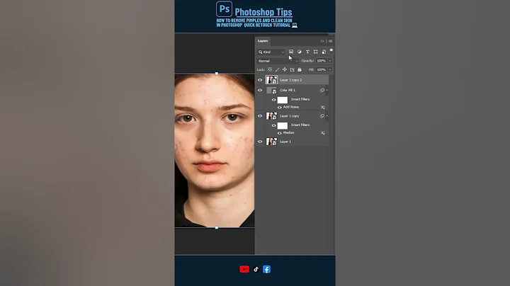 ✨ How to Remove Pimples and Clean Skin in #photoshop  | Quick Retouch Tutorial 💻