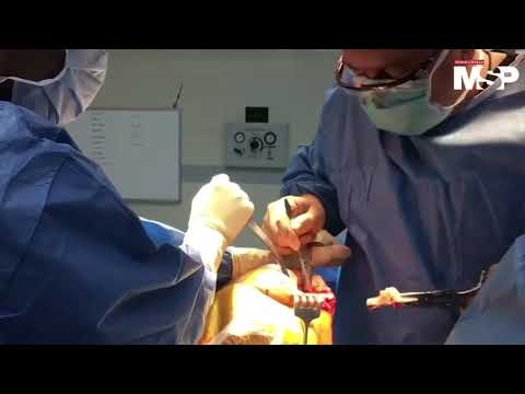 Vídeo: ¿Medicare Cubre La Cirugía De Reemplazo De Rodilla?
