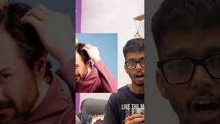 Delhi Hard Water = Hair Fall 😱 | Real Reason Nobody Tells You! #runts #trendingfear #delhi
