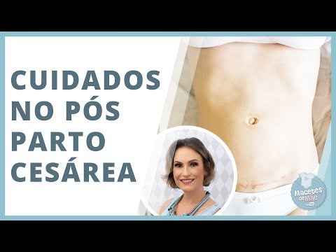 11 CUIDADOS IMPORTANTES PÓS PARTO CESÁREA | MACETES DE MÃE