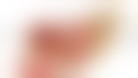 TME for low rectal cancer