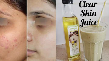 HOW TO CLEAR YOUR SKIN FAST | Get rid of acne in 7 days