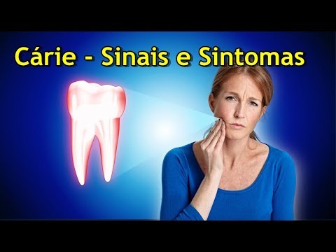 Vídeo: Sinais De Uma Cárie: Quais São Os Sintomas Da Cárie Dentária?