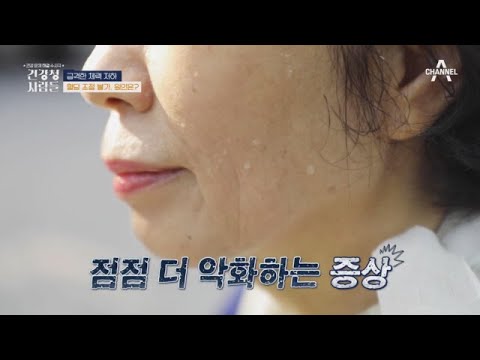 근감소가 부르는 질병 쓰나미  | 건강 <strong>문제</strong> 해결 수사극 건강청 사람들 <strong>19</strong> 회