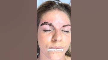 Eyebrows removal short #juliedesigner #removal #usashorts #usamakeup #eyebrow #browdesign #beauty