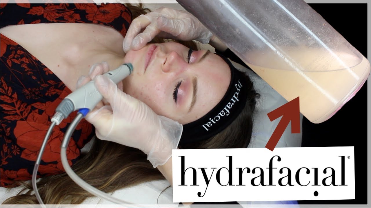 HYDRAFACIAL AVANT / APRÈS  YouTube