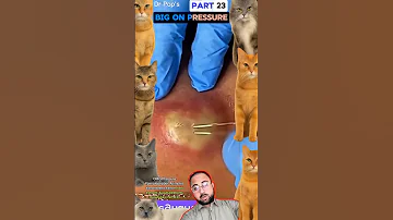 OMG Pressure Pimplepopper Pimples Shortsfeed Shortvideo Shorts Youtubeshorts Youtube Part 23 