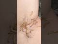 森で虫に刺されたらどうする？すぐ使えるサバイバル対処法#survival_skills #outdoorlife