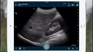 Getting Started with the Clarius App