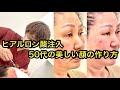 【ヒアルロン酸注入】50代の美しい顔の作り方