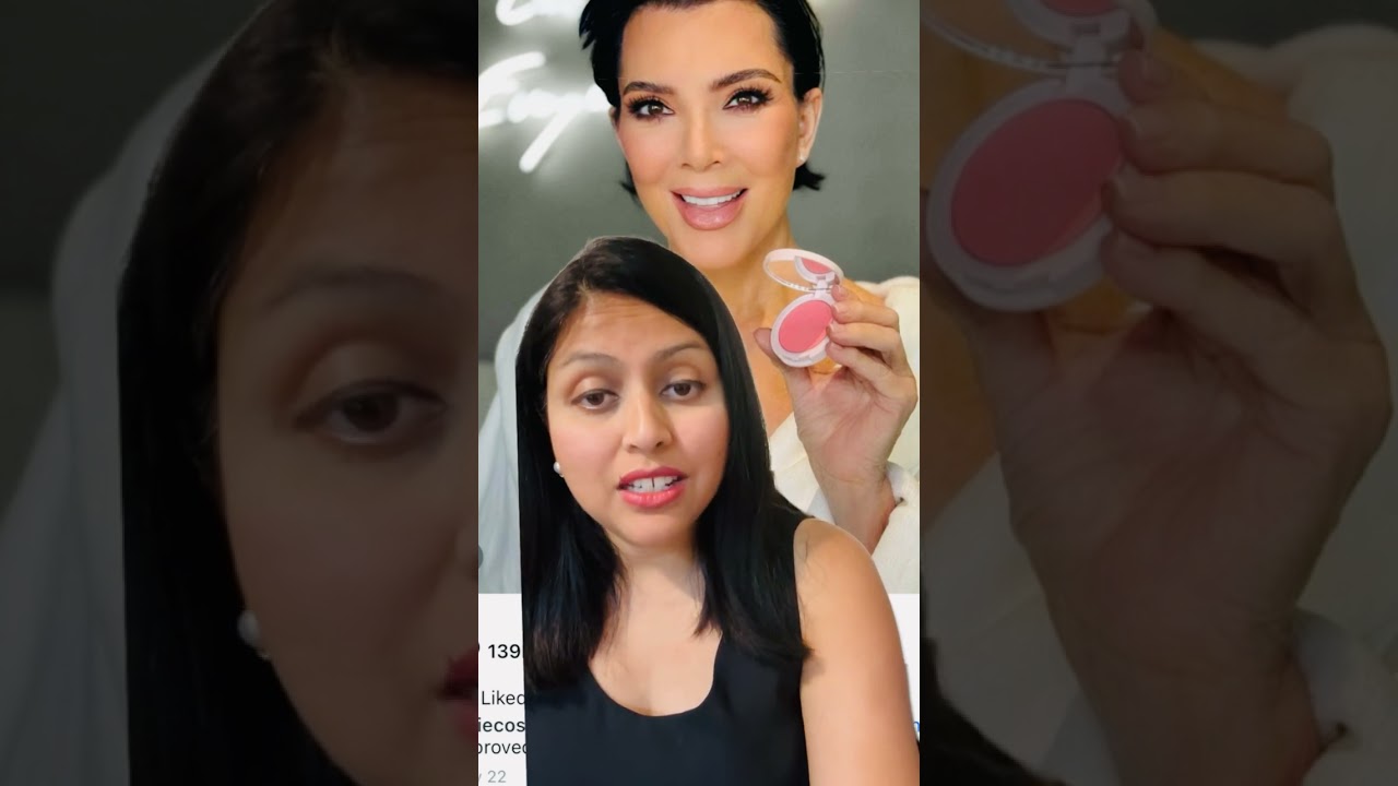 Kris Jenner’s New Face Goes Viral – Before & After!