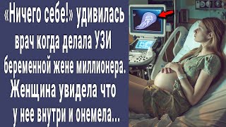 Ничего себе! удивилась врач на УЗИ беременной пациентке. Женщина увидела снимок и побледнела... - 15 