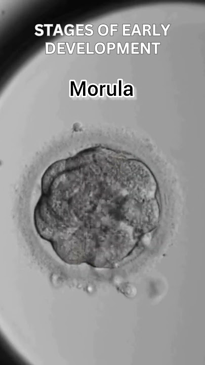 Early development of human | Cleavage | morula | blastulation