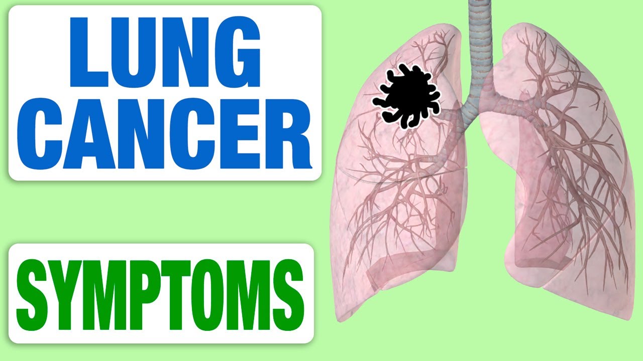 Lung Cancer All Symptoms Youtube