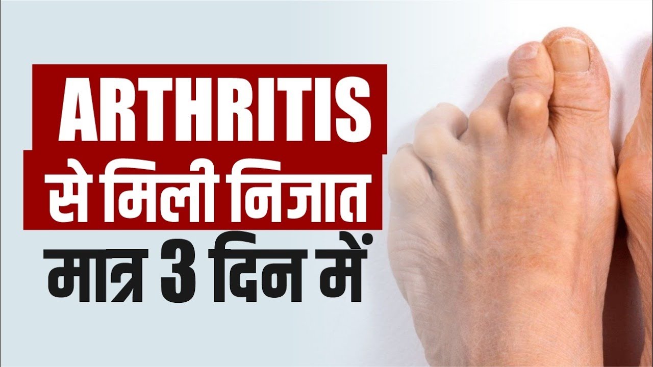 Ayurvedic treatment for Arthritis | Joint Pain  | Acharya Manish ji | Dr Brc | Hiims Hospital