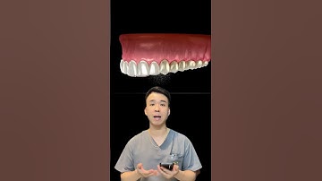 Tẩy trắng răng bằng máng #dentist #nhakhoaquocteachau #tẩytrắngrăng