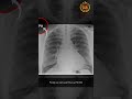 Build a Career in Anesthesia | DANS Course | MIMS Sanjeevani#paramedicalcollege #admissionsopen