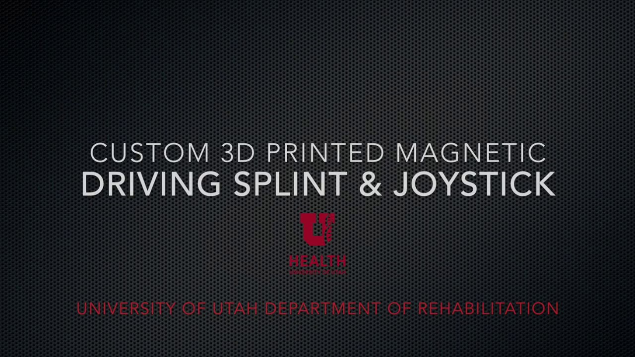 Custom 3D Printed Driving Splint