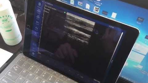 Wireless linear probe video