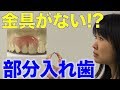 知ってますか?ノンクラスプデンチャー 口腔ケアチャンネル 711(口腔ケアチャンネル2 #384)