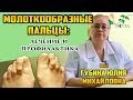 Молоткообразные пальцы. Индивидуальные ортопедические стельки. Рассказывает Губина Юлия Михайловна.