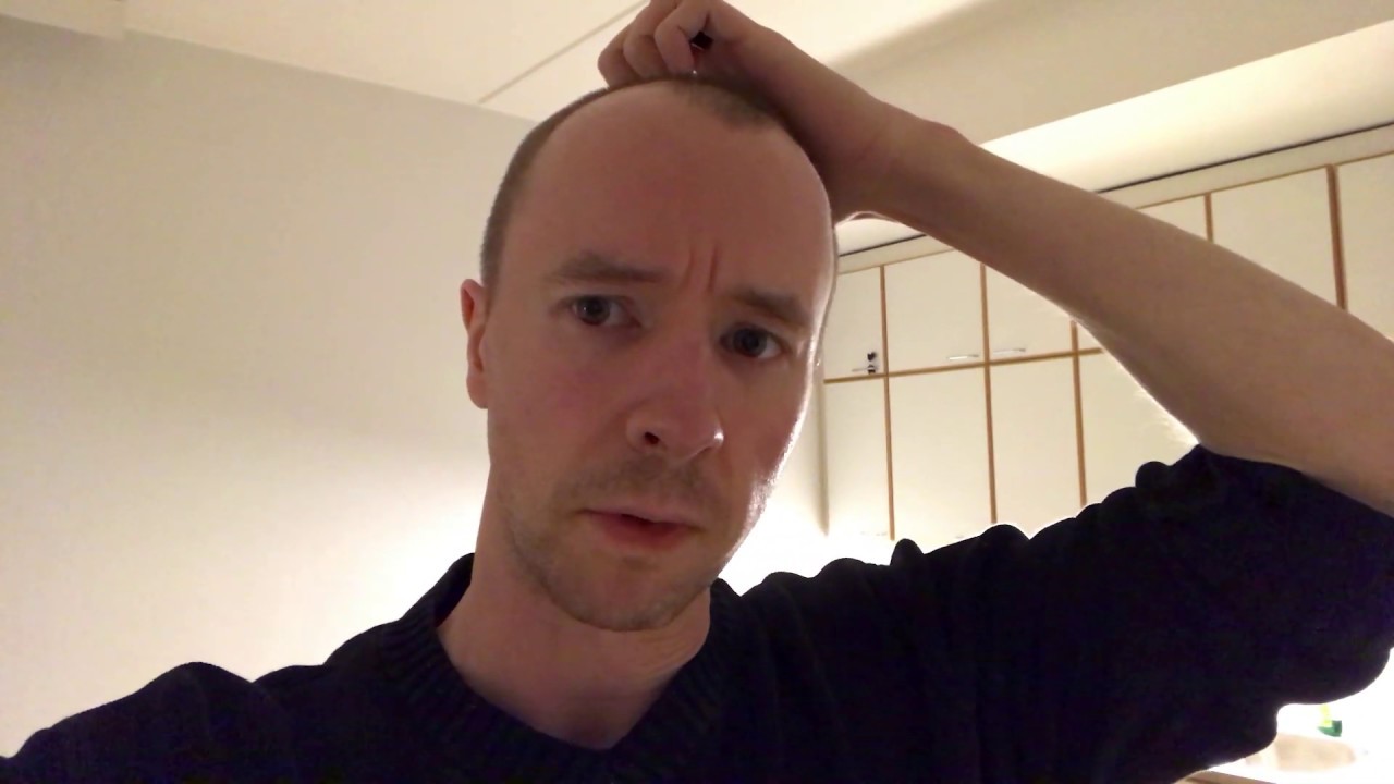 Resveratrol & NMN Side Effects What Might Happen YouTube