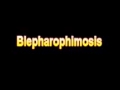 What Is The Definition Of Blepharophimosis Medical Dictionary Free Online