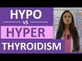 Hypothyroidism vs Hyperthyroidism Nursing NCLEX | Hypothyroidism and Hyperthyroidism Difference