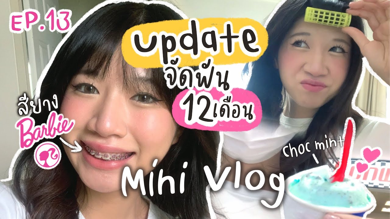 🦷UPDATE🦷 จัดฟัน 12 เดือน สียางBarbie! , mini vlog EP.13 (มีต่อฮัฟ) | SOMz