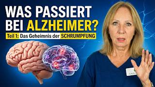 Warum du Alzheimer früh erkennen musst – Gehirnatrophie erklärt | Dr. Claudia Bignion