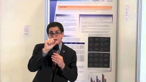 SDMT for Cognitive Dysfunction